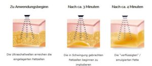 Schwingungen