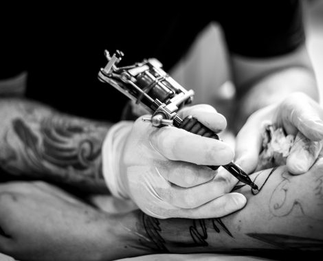 tattooentfernung