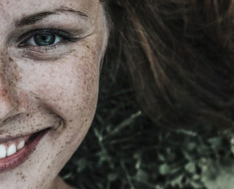 sommersprossen-hautklar-skin-conscept