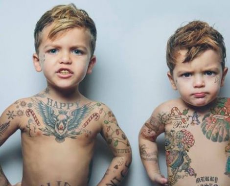 Tattooentfernung