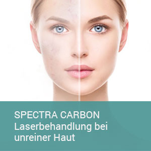 unreine-haut-SPECTRA-CARBON-300x300